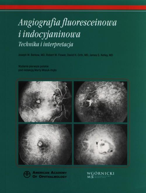

Angiografia fluoresceinowa i indocyjaninowa Techni