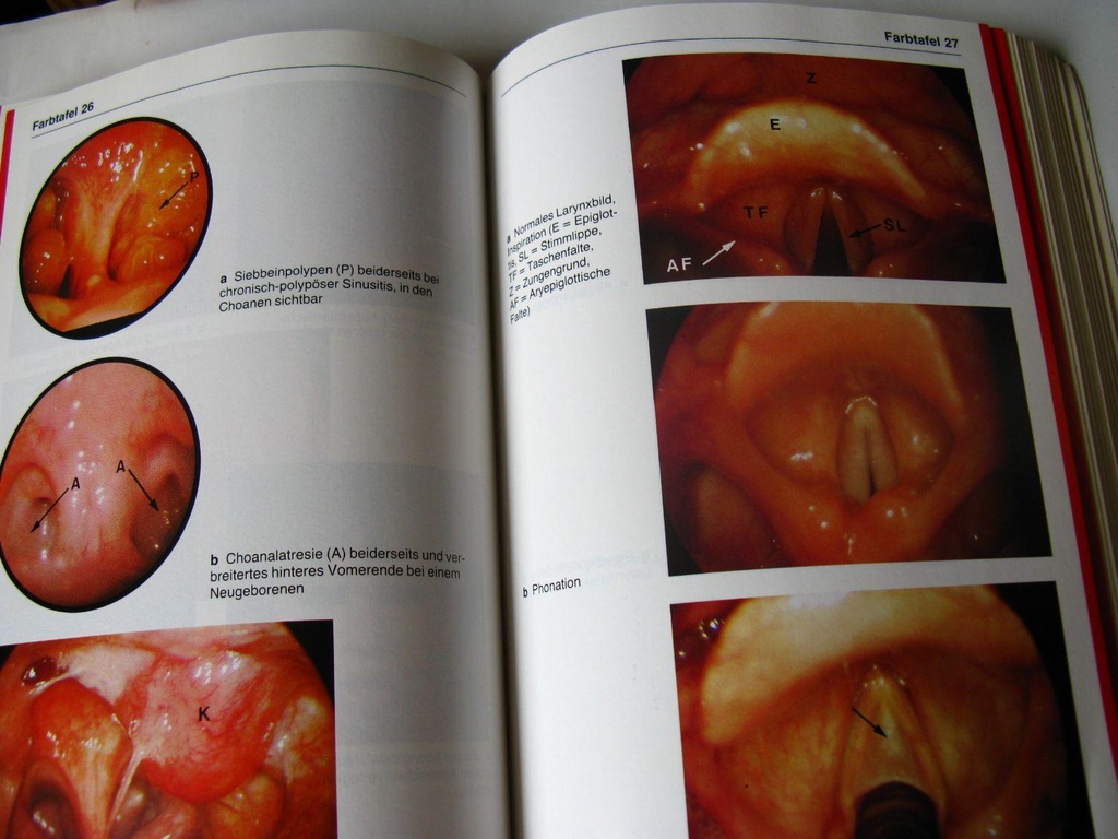 NOS GARDŁO USZY Laryngologia ______ATLAS niemiecki