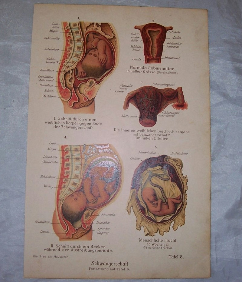 CIĄŻA. GRAFIKA. 1905.