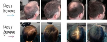 Hair Plus 12g Zagęszczanie Mikrowłókna NOWOŚĆ