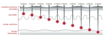 DERMA ROLLER DRS 540 IGIEŁ TYTAN 1,0 MM