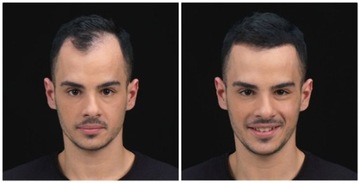 KMAX Микрофибра для утолщения волос 32 г Средне-коричневый